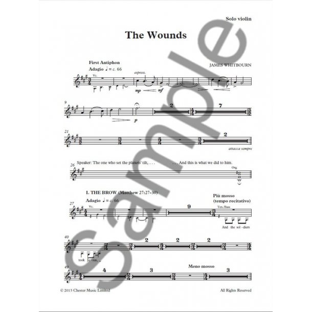 James Whibourn: The Wounds (Parts)