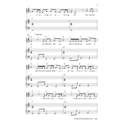 Alessia Cara: Scars To Your Beautiful (SAB)